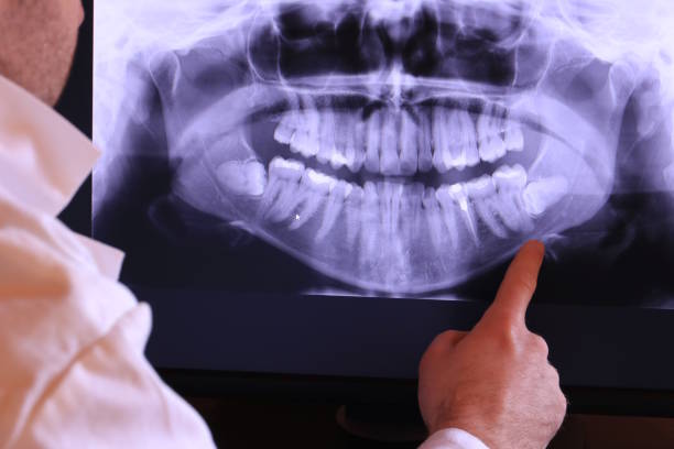 Best Emergency Dental Care for Broken or Chipped Teeth in Zeeland, MI