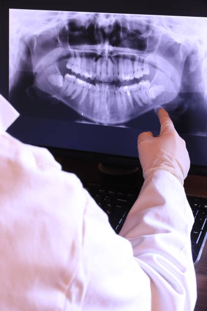 Best Emergency Wisdom Teeth Removal in Zeeland, MI